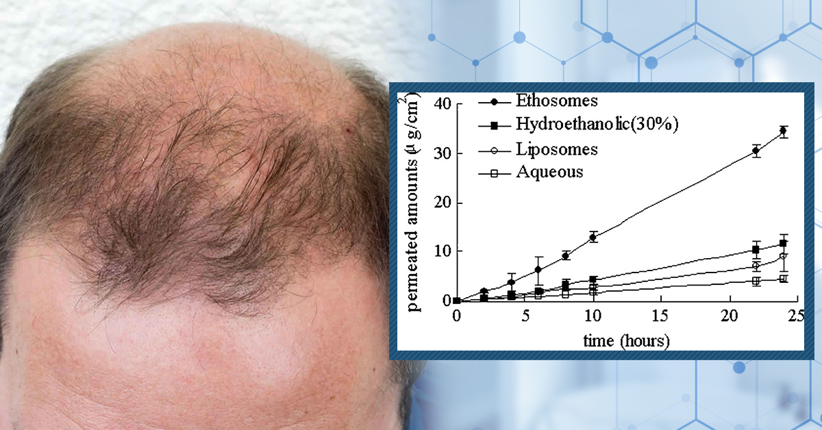 How long does finasteride stay in the scalp tissue