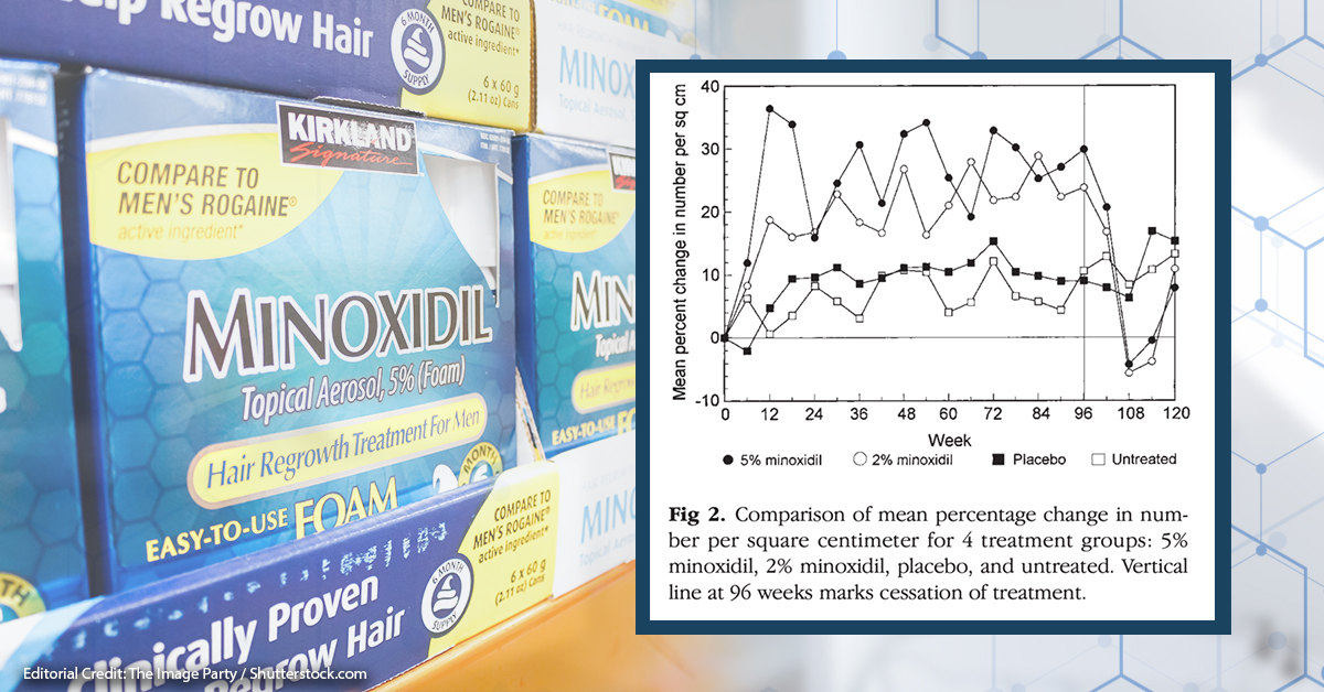How much Regrowth Should I expect from Minoxidil?