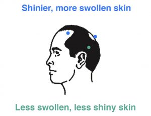 Balding Shinier Skin