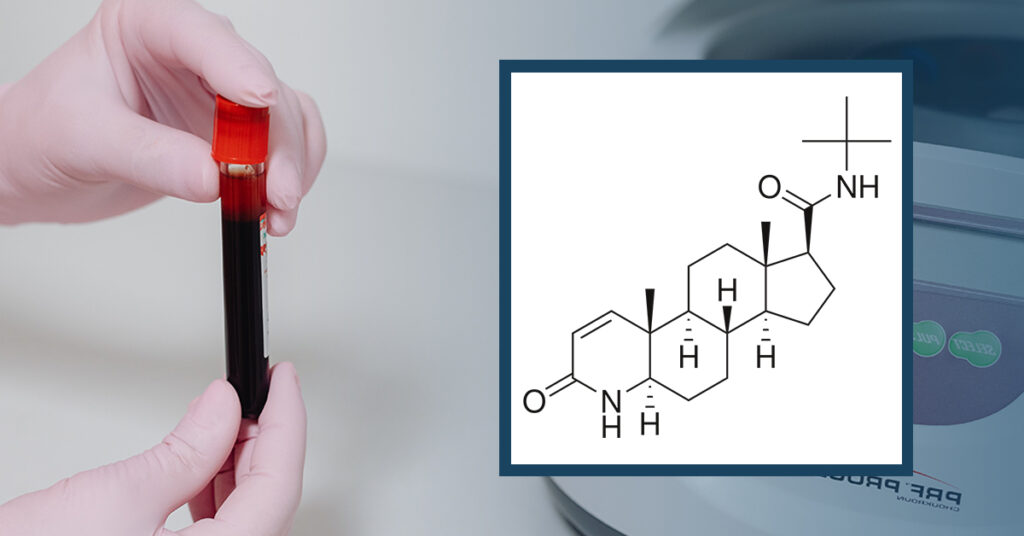 Blood Tests Risk of Finasteride