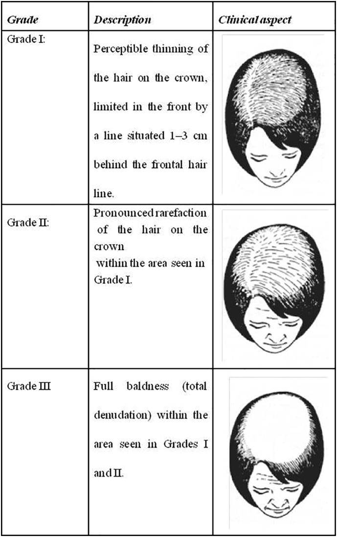 Photo of pattern hair loss on women