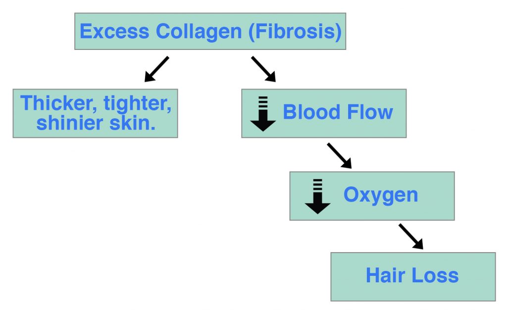 Fibrosis Blood Flow Oxygen Hair Loss