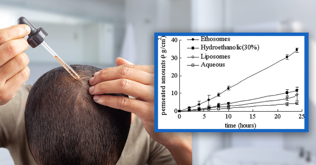 Topical finasteride