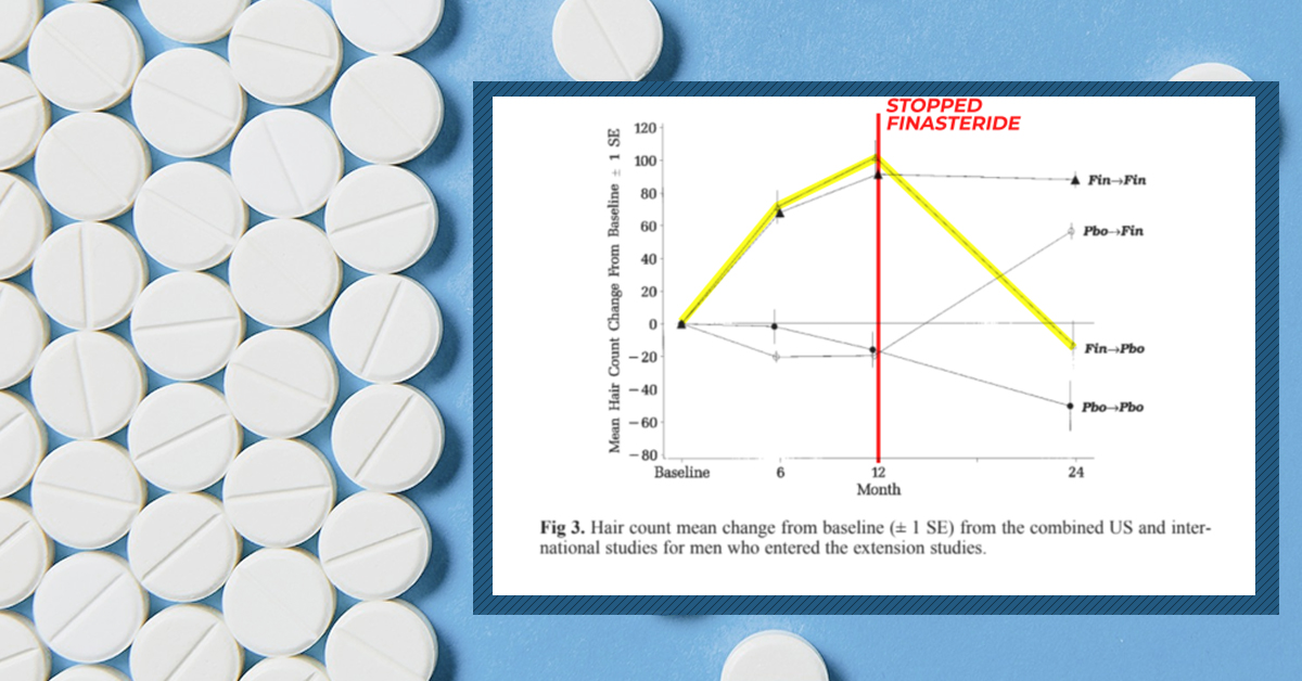 post finasteride syndrome