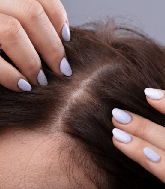 Photo of woman with hair loss