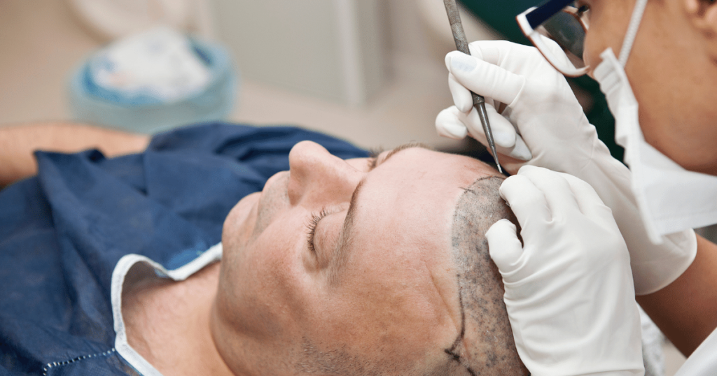 A man having a hair transplant