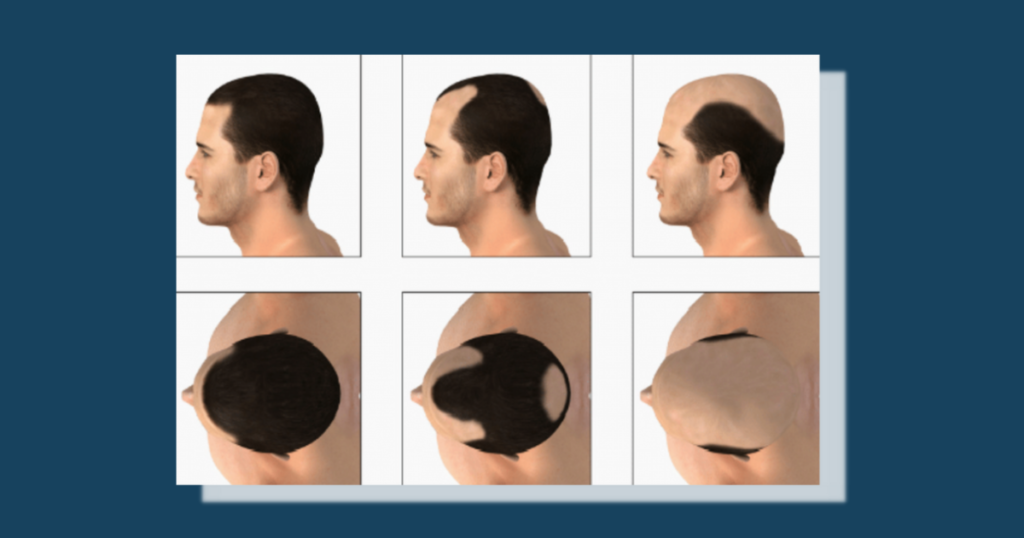 Parts of Scalp graphic