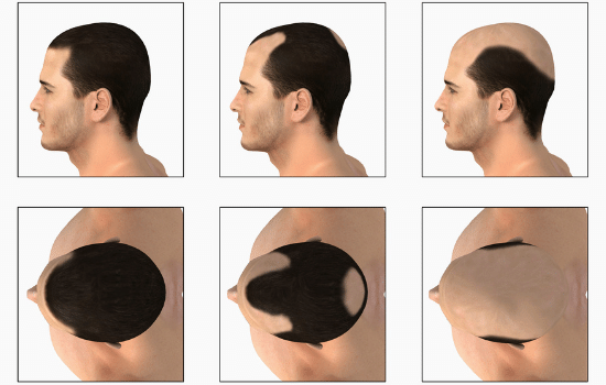 men hair shedding illustration