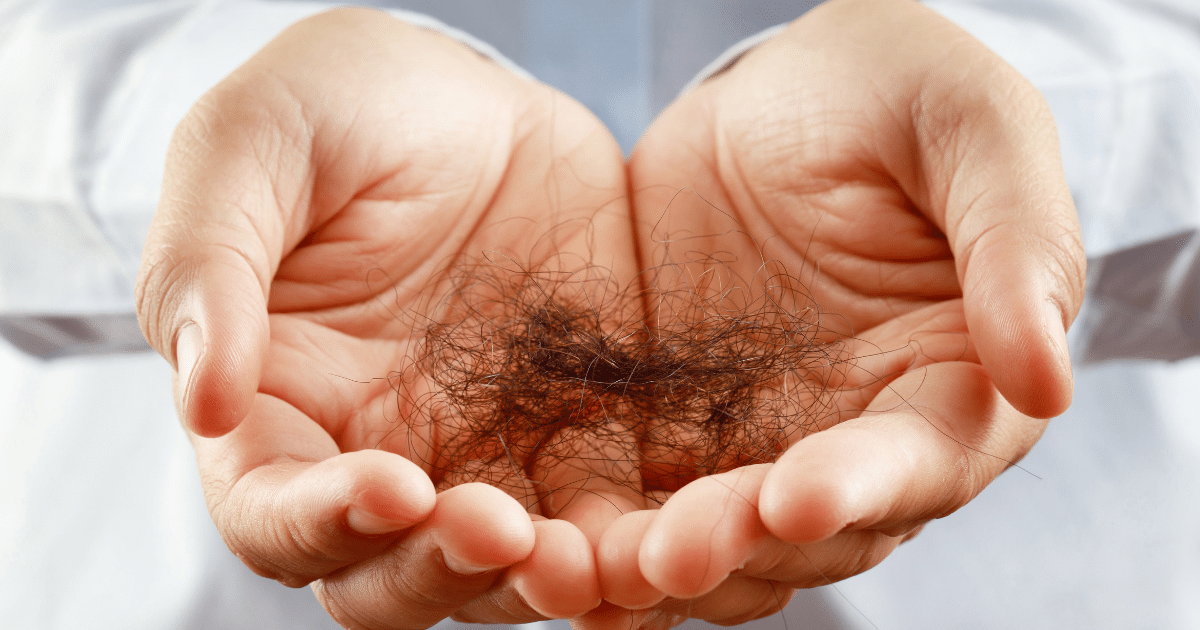 Hands full of shedded hair from quitting minoxidil